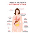 Tissues of the body affected by autoimmune attack