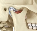 TMJ: The temporomandibular joints. Healthy occlusion anatomy. Medically accurate 3D illustration of human teeth and dentures