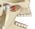 TMJ: The temporomandibular joints. Healthy occlusion anatomy. Medically accurate 3D illustration of human teeth and dentures Royalty Free Stock Photo