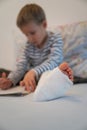 Toddler boy with broken leg in a cast