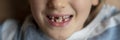 Toddler boy smiling with missing baby teeth Royalty Free Stock Photo