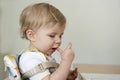 Toddler with hand , foot and mouth disease Royalty Free Stock Photo