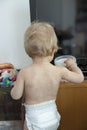 Toddler with hand , foot and mouth disease Royalty Free Stock Photo