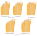 Toe shape