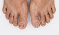 Toes of Asian elder man. Concept of aging Royalty Free Stock Photo