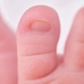 Toes on the foot of a newborn baby, close-up. Macro photo of a healthy toe of a child Royalty Free Stock Photo