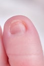 Toes on the foot of a newborn baby, close-up. Macro photo of a healthy toe of a child