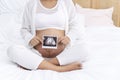 Tomography analyzed before birth concept. Pregnant young woman showing ultrasound over own belly with growth baby sex Royalty Free Stock Photo