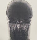 tomography of human head.. no pathologies