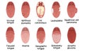 Tongue disease illustration