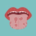 Tongue disease, vector of organ concept