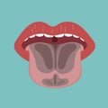Tongue disease, vector of organ concept Royalty Free Stock Photo