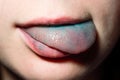 Tongue and lips painted blue food coloring