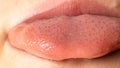 Macro photo of healthy human language. Tongue papillae taste buds and taste. Close up