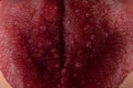 tongue with stomatitis close up, oral cancer