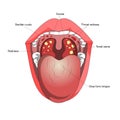 Tonsillitis diagram medical science