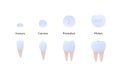 Tooth anatomy chart. Vector biomedical illustration. Incisor, canine, molar, premolar color icon set isolated on white background Royalty Free Stock Photo