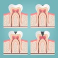 Tooth anatomy