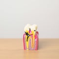 tooth Anatomy model. Oral Teeth decay and disease, Scrape off tartar. March Oral health, Dentist Day, False Teeth. Toothache and