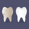 Tooth before and after bleaching and cleaning