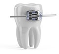 Tooth with braces isolated on white. Tooth 3d icon. Health, medical, tooth doctor, dental clinic or dentist symbol