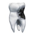 Tooth with caries, toothache concept. 3D rendering