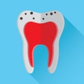 tooth with caries. Vector illustration decorative design Royalty Free Stock Photo