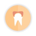 tooth with cavity. Vector illustration decorative design Royalty Free Stock Photo