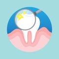 tooth checkup. Vector illustration decorative design Royalty Free Stock Photo
