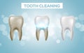 Tooth clean 3d health. Dental realistic dirty whitening. Dentist teeth hygiene isolated medicine template