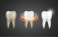 Tooth clean 3d health. Dental realistic dirty whitening. Dentist teeth hygiene medicine template