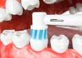 Tooth cleaning occlusal surfaces - 3D Rendering Royalty Free Stock Photo