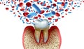 Tooth Decay Blood Bacteria