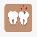 Tooth decay, caries icon. Healthy tooth and decayed tooth for dental care concept