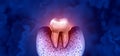 Tooth Decay Disease Royalty Free Stock Photo