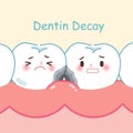 Tooth with dentin decay