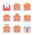 Tooth dentistry, dental teeth, oral toothache, isolated on white, medical hygiene, design, in style cartoon vector