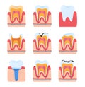 Tooth dentistry, dental teeth, oral toothache, isolated on white, medical hygiene, design, in style cartoon vector