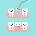 Tooth extraction and implantation stomatology concept, cute colorful teeth implant vector illustration