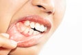 Tooth extraction and oral health