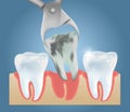 Tooth extraction vector medical poster design template