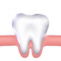 Tooth and gums