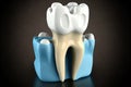 tooth that has been prepared for a dental crown. medical precision