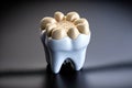 tooth that has been prepared for a dental crown. medical precision