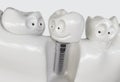 Tooth human cartoon implant - 3D Rendering Royalty Free Stock Photo