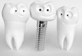 Tooth human cartoon implant - 3D Rendering Royalty Free Stock Photo