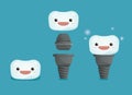 Tooth implant 3 step of dental