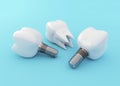 Tooth Implants and Tooth Crown