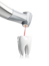 tooth treatment process