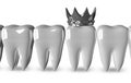 Tooth with metallic crown